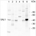 SAL1 | Sal1 phosphatase